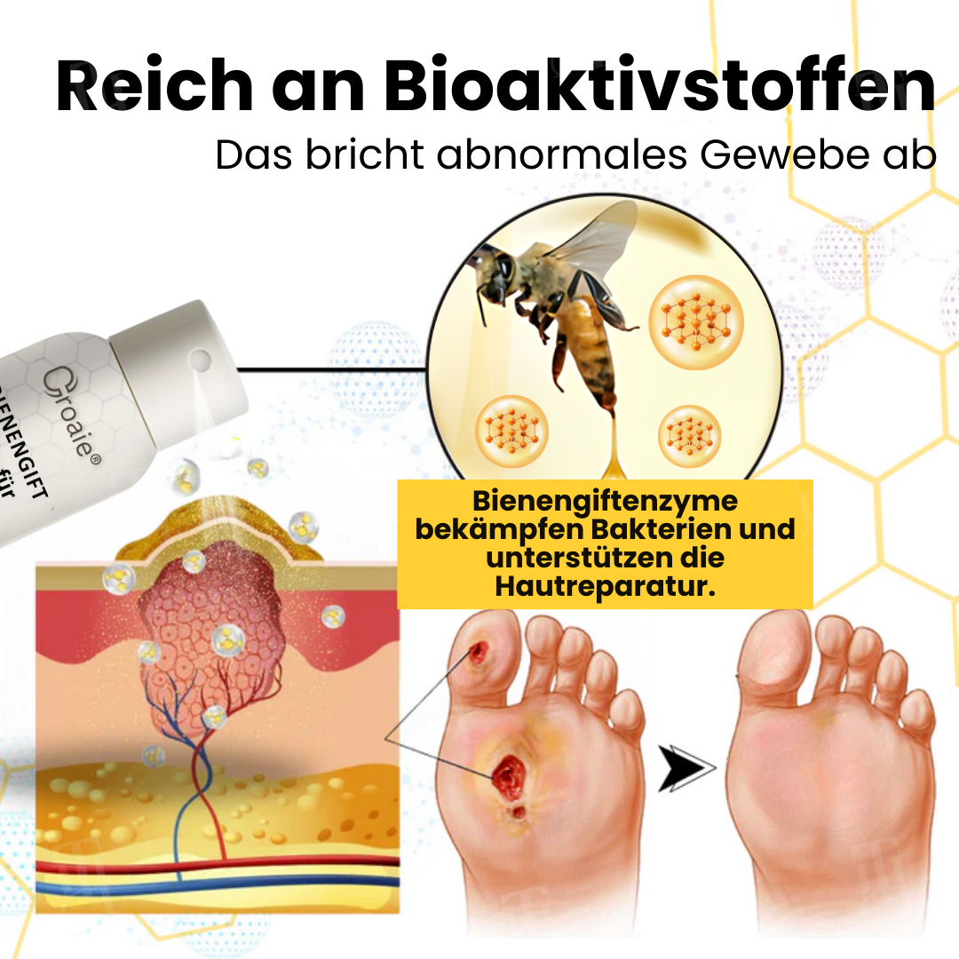 Croaie® Bienengift Spray für Diabetische Fußgeschwüre