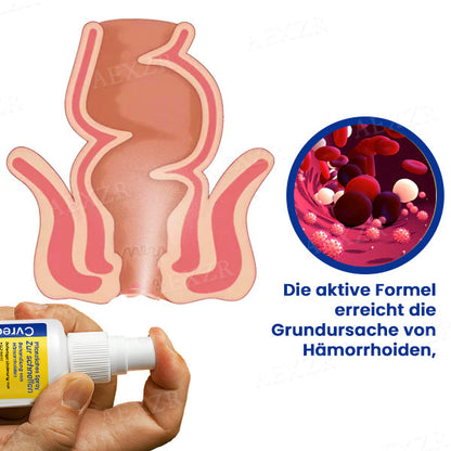 Cvreoz® Pflanzliches Spray zur schnellen Behandlung von Hämorrhoiden