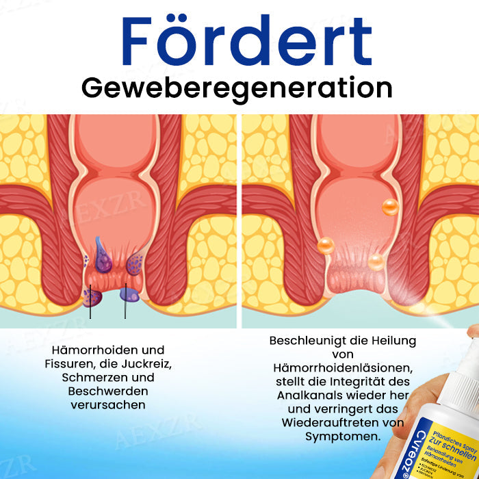 Cvreoz® Pflanzliches Spray zur schnellen Behandlung von Hämorrhoiden