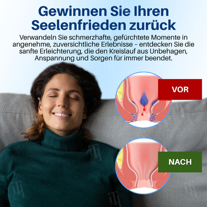 [Offizieller Shop] Cvreoz® Hämorrhoiden & Fissurencreme-In 7 Tagen schmerzfrei – garantiert!