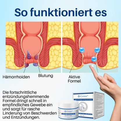 [Offizieller Shop] Cvreoz® Hämorrhoiden & Fissurencreme-In 7 Tagen schmerzfrei – garantiert!