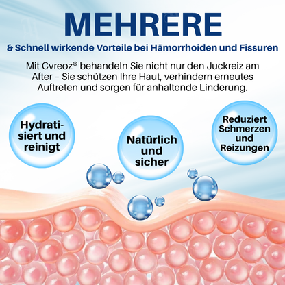 [Offizieller Shop] Cvreoz® Hämorrhoiden & Fissurencreme-In 7 Tagen schmerzfrei – garantiert!